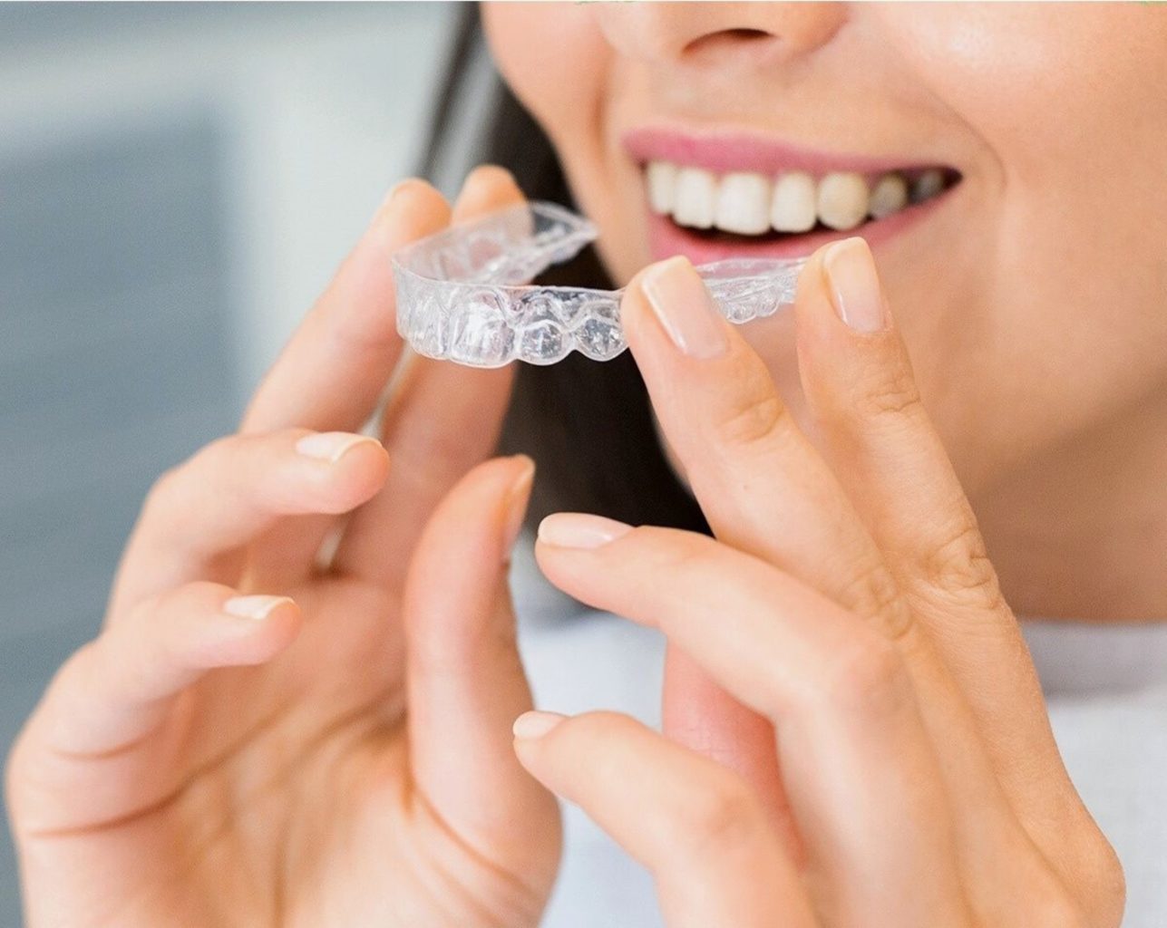 Invisible Braces 2024: These Companies Offer Them at Home, So You